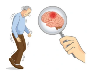 best-parkinsonism-services-Miyapur, Hyderabad