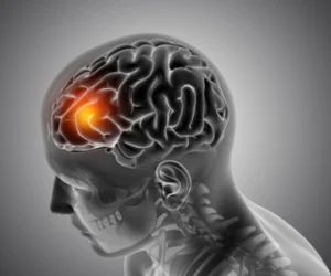 best-stroke-services-Miyapur, Hyderabad